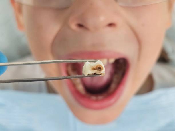 Best Emergency Treatment for Oral Infections in Greensburg, PA